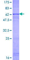 12.5% SDS-PAGE Stained with Coomassie Blue.